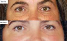 Load image into Gallery viewer, Corrective Eye Concentrate