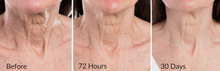 Load image into Gallery viewer, Smoothing Neck Serum